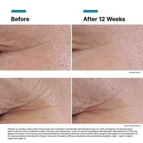 SkinCeuticals P-TIOX Wrinkle Modulating Peptide Serum 1 fl oz / 30ml